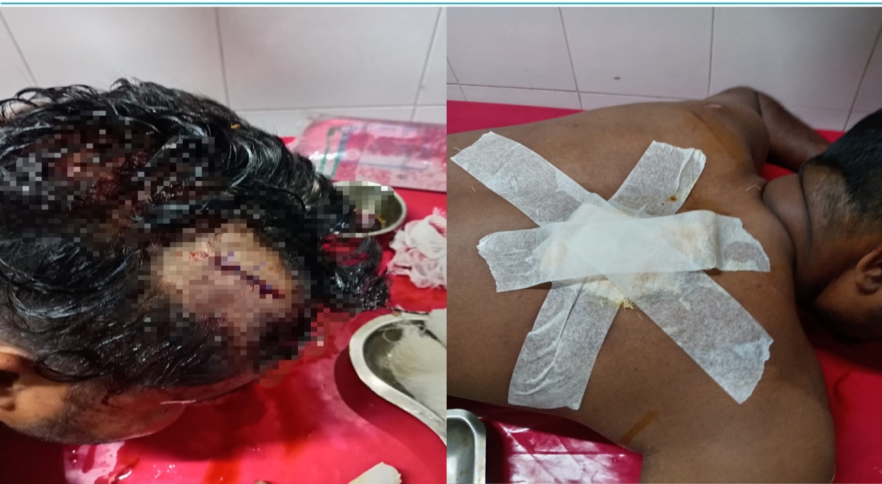 সাতক্ষীরায় অ্যাম্বুলেন্স চালককে কুপিয়ে ও পিটিয়ে হত্যার চেষ্টা: নগদ টাকা লুট, গাড়ি ভাঙচুর!