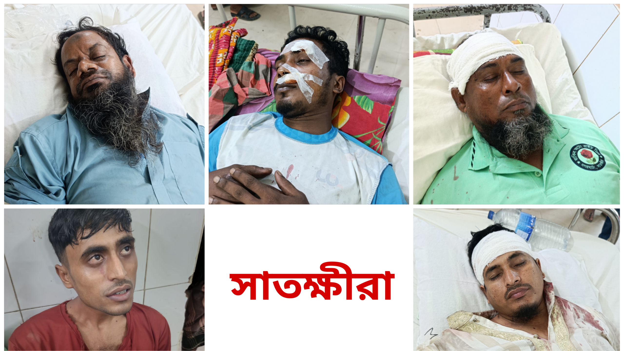 সাতক্ষীরায় অ্যাম্বুলেন্স উপহারকে কেন্দ্র করে হা-ম-লায় র*ক্তা*ক্ত চেয়ারম্যান প্রার্থীসহ ১০, সাবেক চেয়ারম্যানের বিরুদ্ধে অভিযোগ